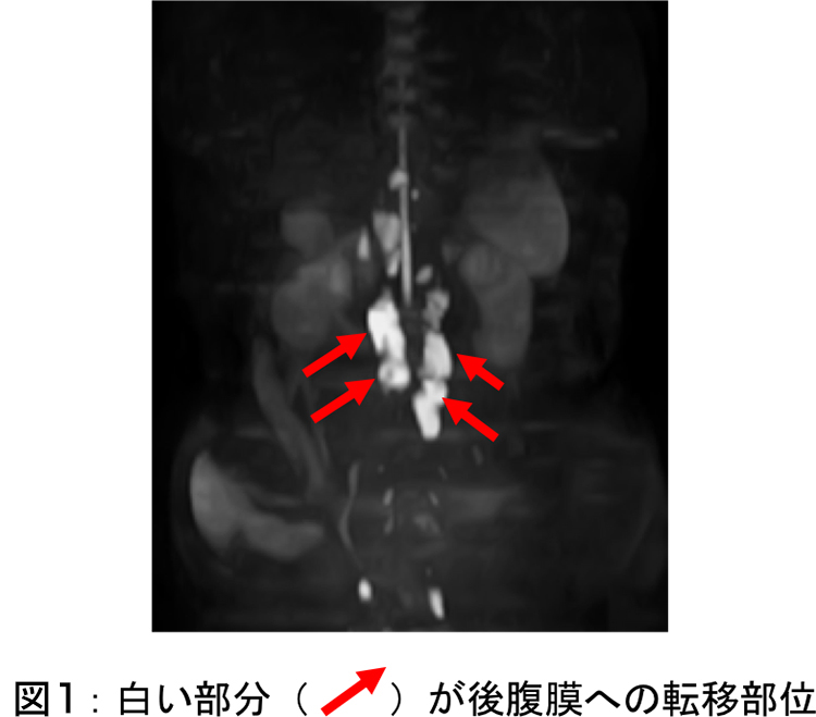 図1